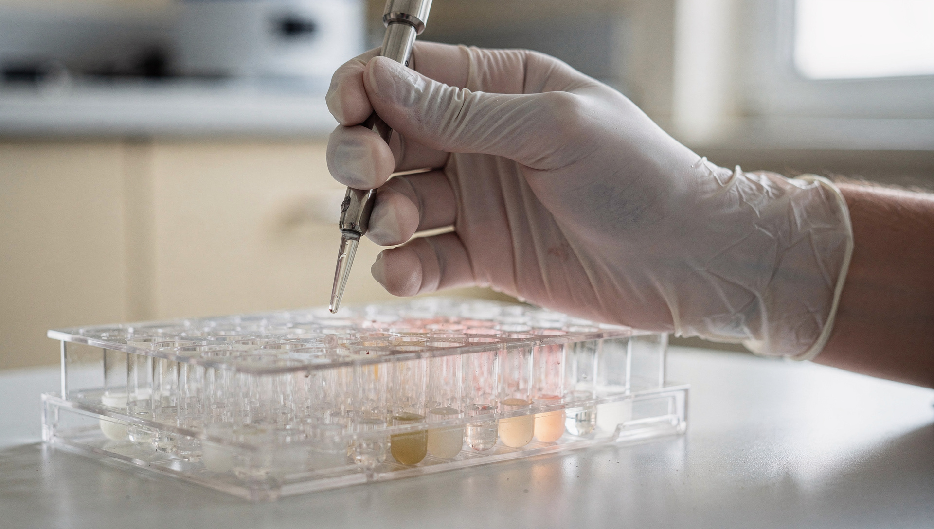 Merck paga $400M por activo preclinical y cae 1%